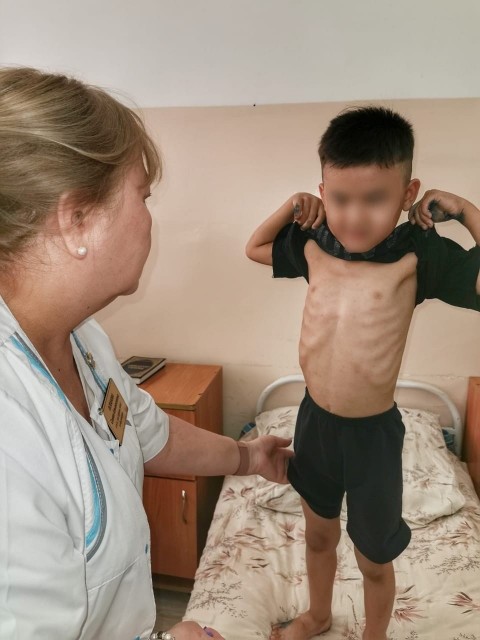 85 юных пациентов приняли в Атырау врачи КНЦДИЗ
