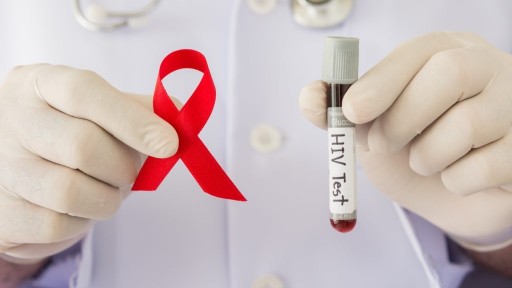 The number of new HIV cases registered in Kazakhstan has decreased: how does GOBMP affect this?